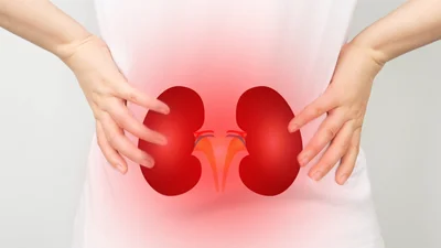 Acute Kidney Injury & CKD